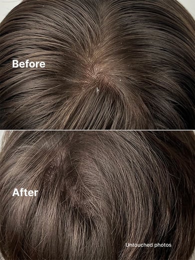 Gentle Scalp Exfoliator
