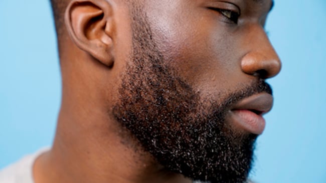 Boutons sous la barbe : quelles solutions ? Suivez le guide