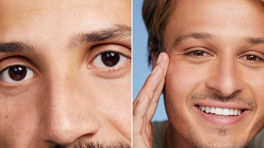 The difference between dark circles and under-eye bags