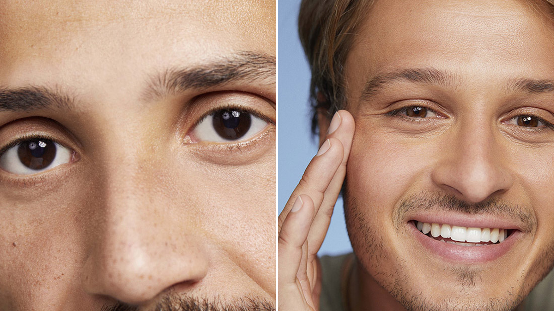 Can Under Eye Bags be Removed Without Surgery? - Ocala Eye